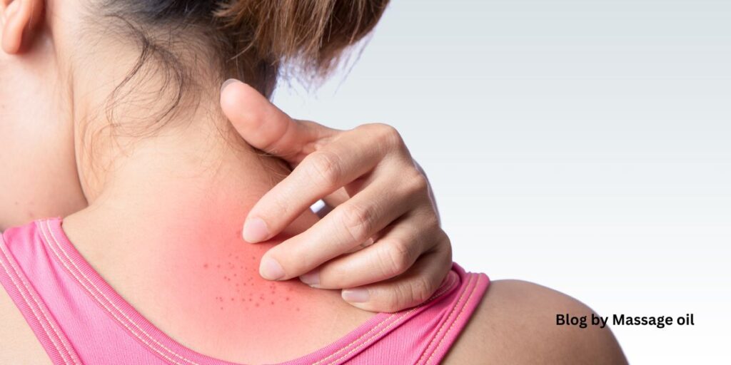 A girl suffering from skin irritation